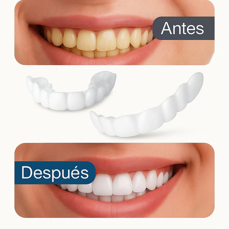 Compre 1 Lleve 2 - Set Carillas Dentales EasySmile [TU SONRISA PERFECTA]